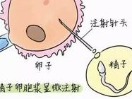 促排卵泡长太快了说明什么？